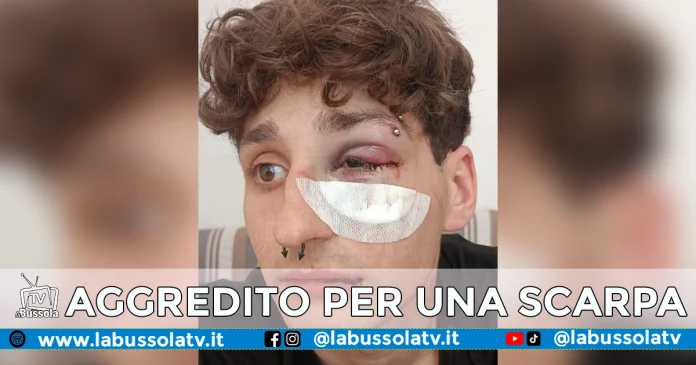 AGGREDITO PER SCARPA SPORCATA