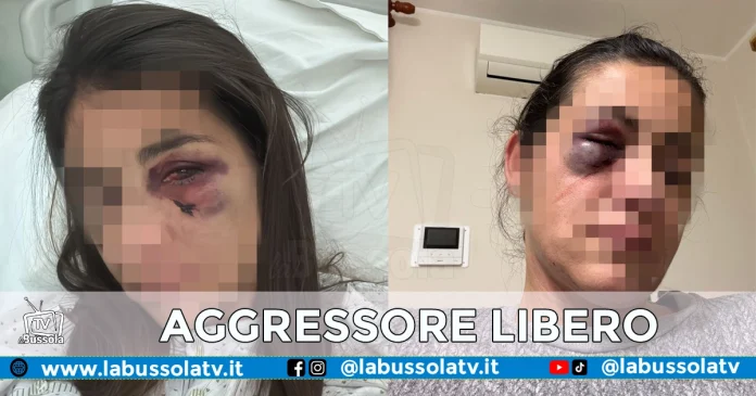 DONNA VITTIMA VIOLENZA SANT'ANASTASIA