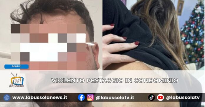 Foglie sul balcone, scoppia la violenza lite condominiale degenera in pestaggio a Portici. La denuncia del M5S